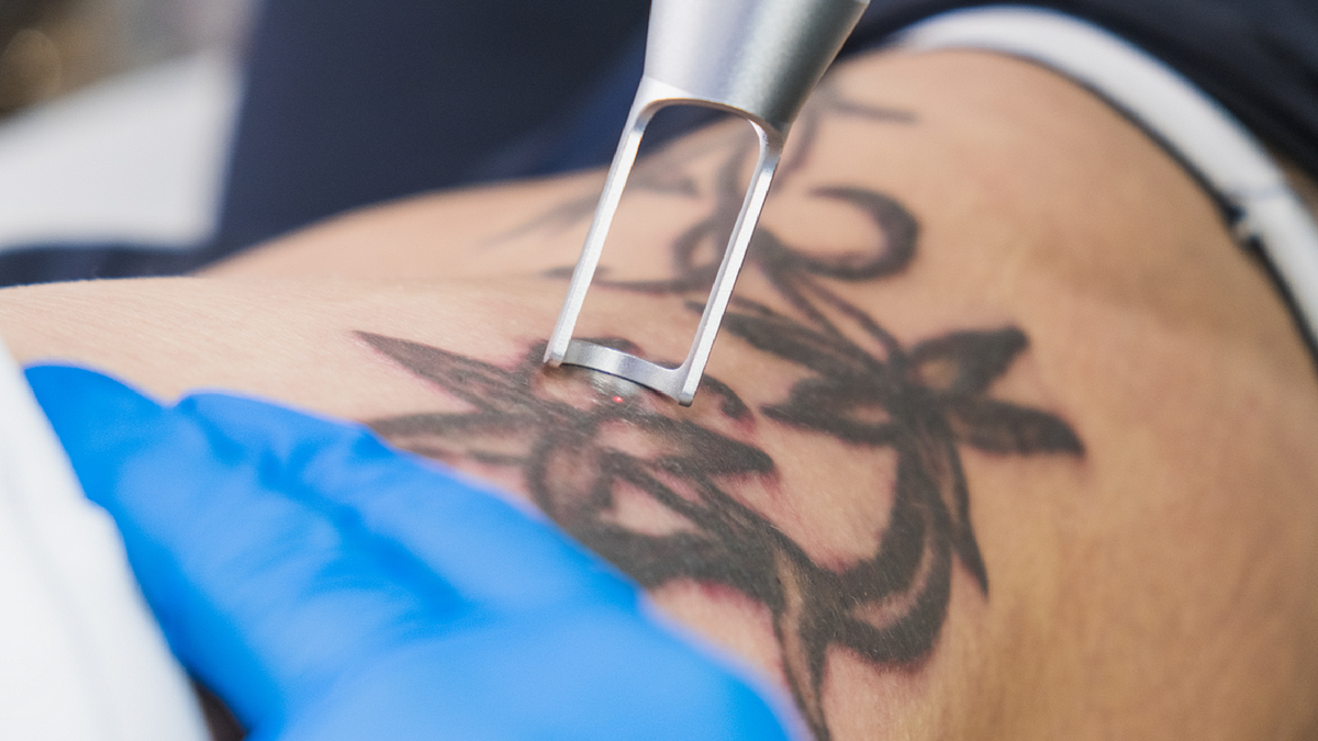 Pico Laser Skin Resurfacing