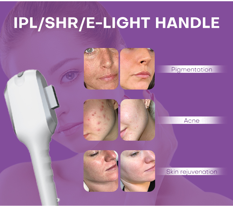 ipl shr elight handle