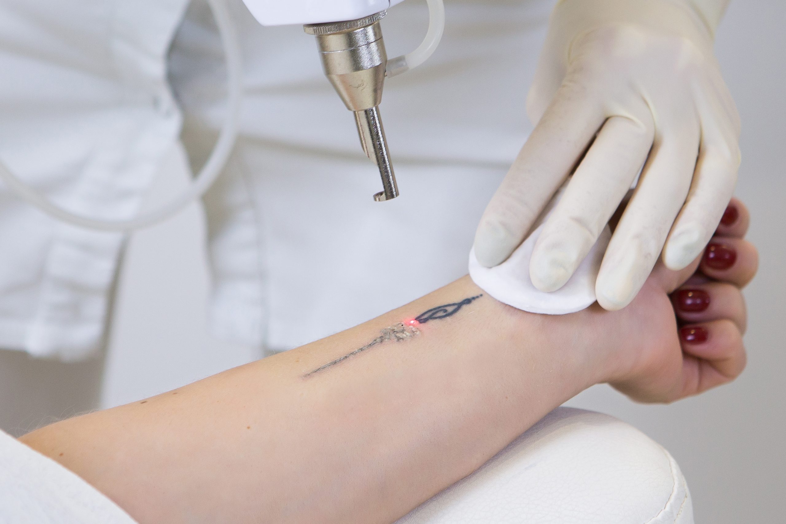 Why Picosecond Laser Machines Are The Future of Aesthetic Treatments