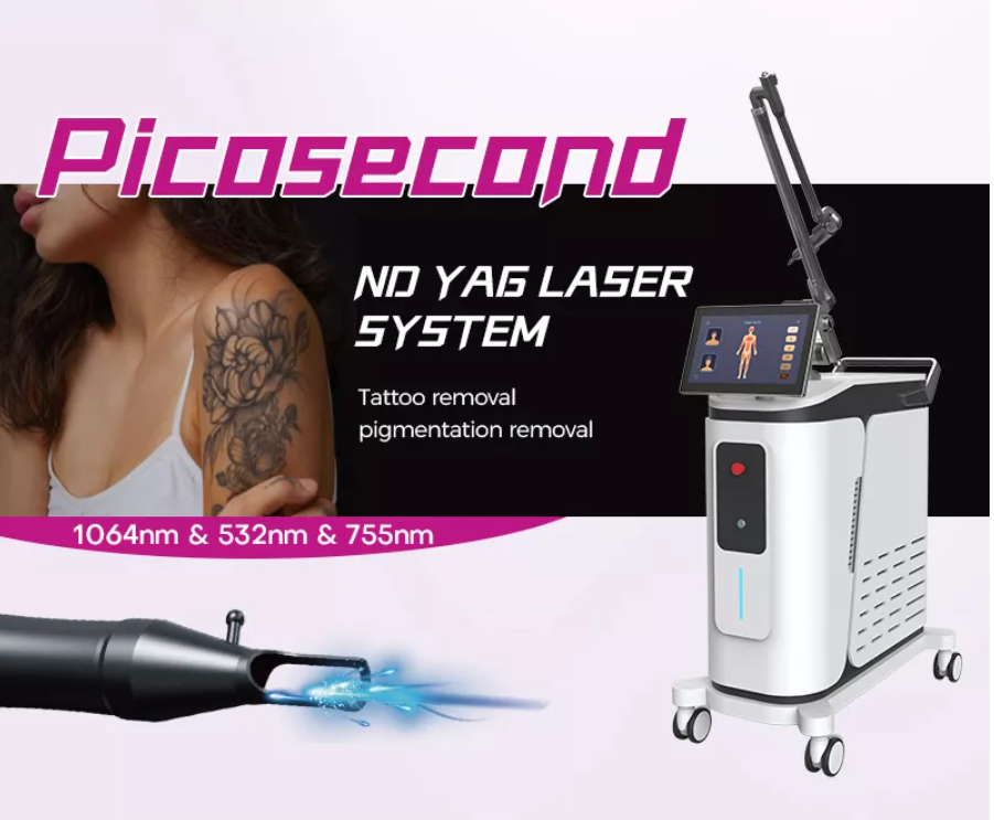 nd yag laser