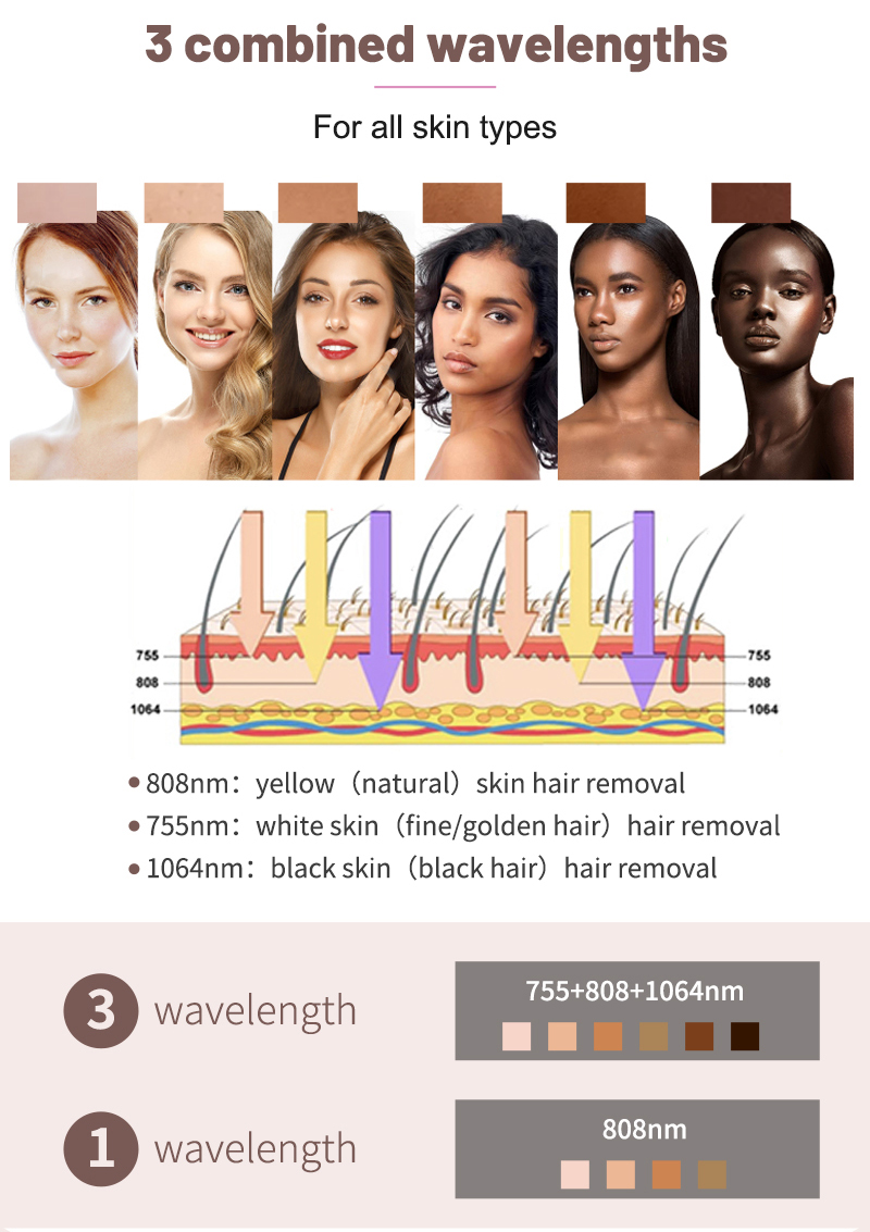 groupon laser hair removal