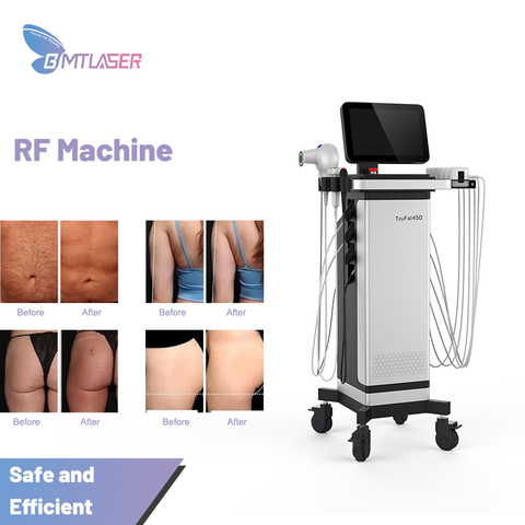 Trusculpt Fat Reduce Radio Frequency Id Flex Trushape Machine