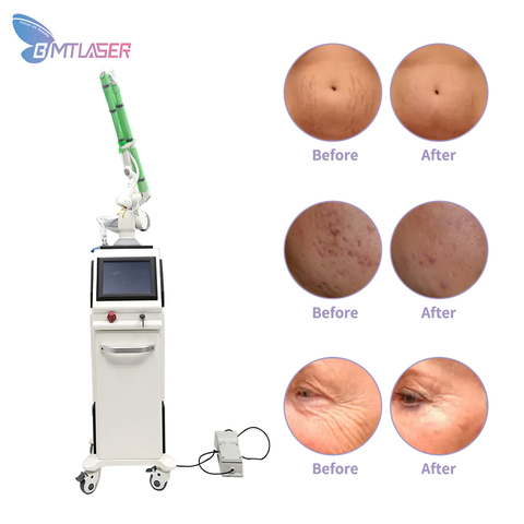 Fractional Co2 Laser Machine Price Vaginal Tightening