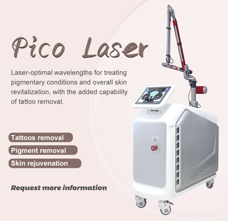laser tattoo removal machine