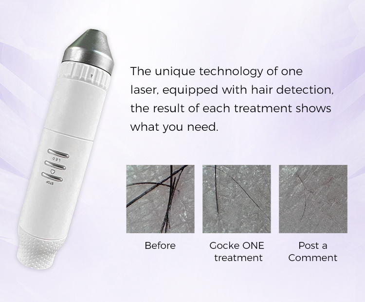 Professional Diode Laser Hair Removal Machine With 755nm 808nm 940nm 1064nm 