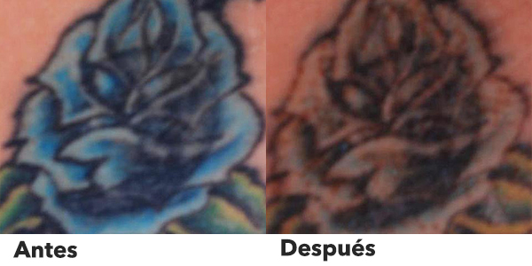 picosecond laser machine