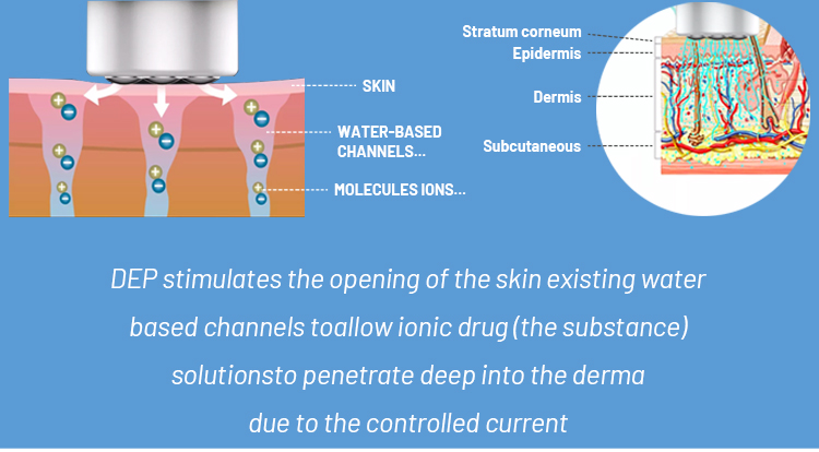 smas lifting machine