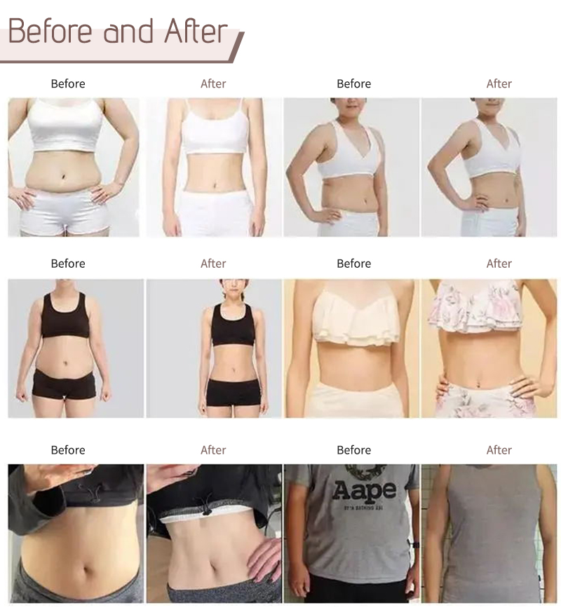 7d hifu before and after