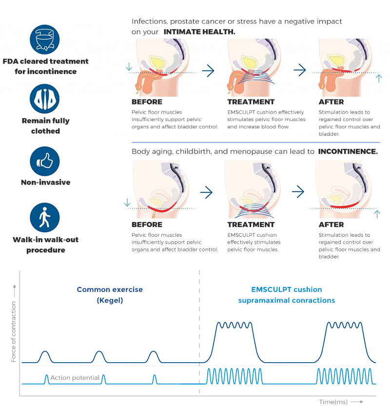 emsculpt neo machine price