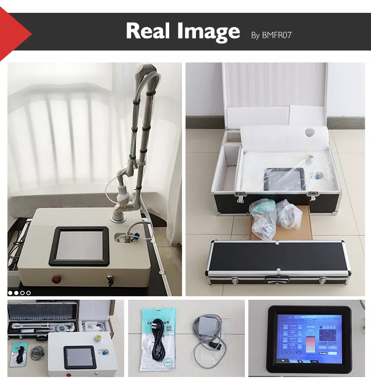 co2 laser resurfacing cost