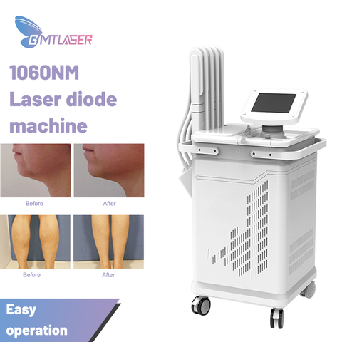 Fat Reduction 1060nm Laser Diode Slimming Machine DL1060