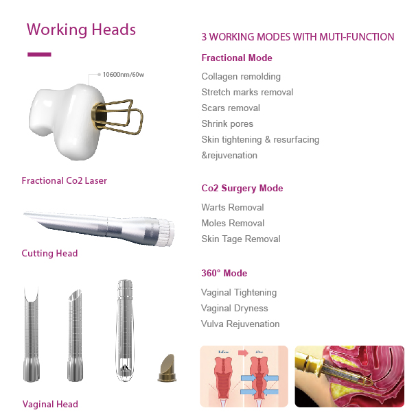 fractional co2 laser machine price