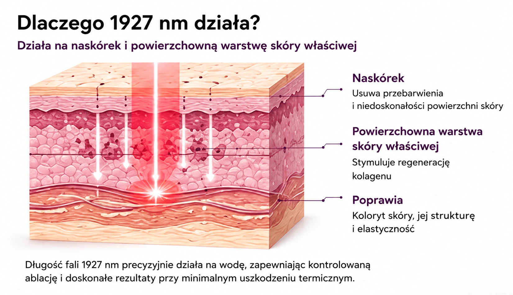 laser frakcyjny