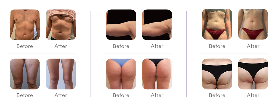 before and after