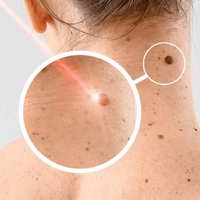Improve pigmentation