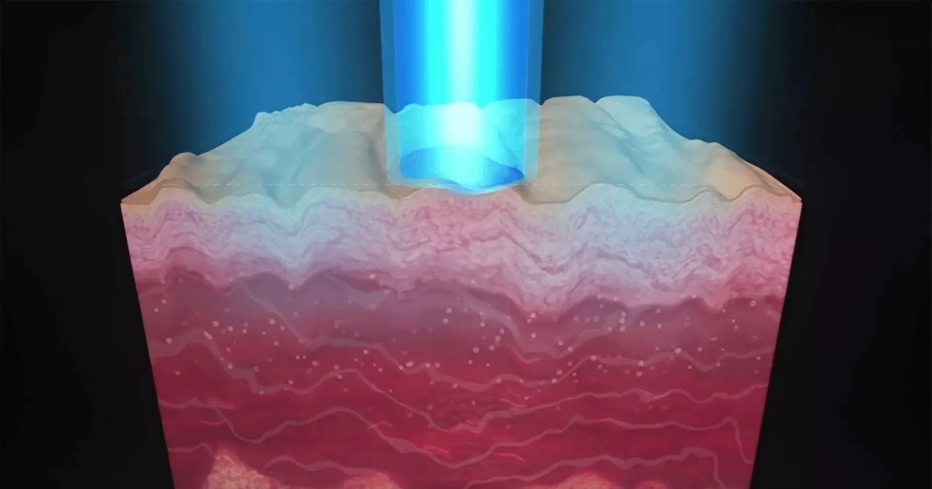 picosecond laser machine